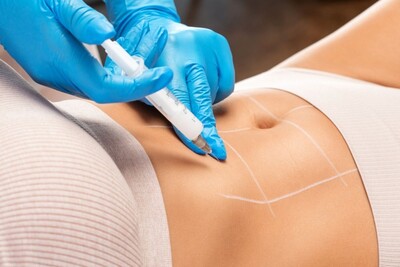 Link to: https://www.suffusewellness.com/pcdc-fat-dissolving-injections-midland